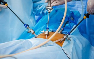 Laparoscopic Surgery In Jaipur