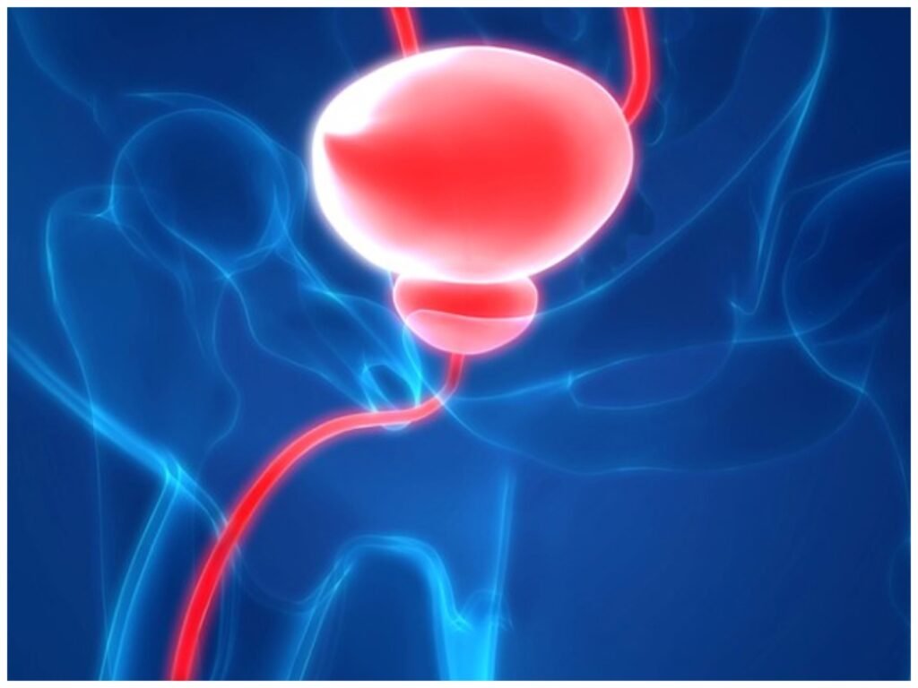 Prostrate Laser Surgery Dr. Rajan Bansal