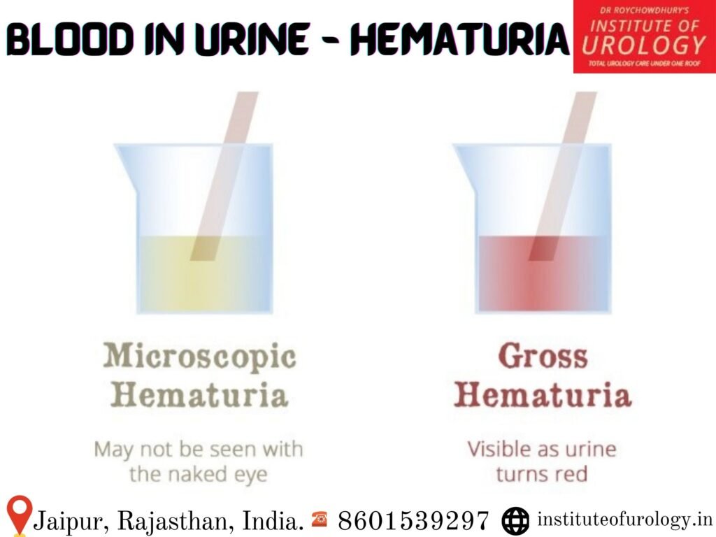 Dr Rajan Bansal Best Urologist in Rajasthan Jaipur