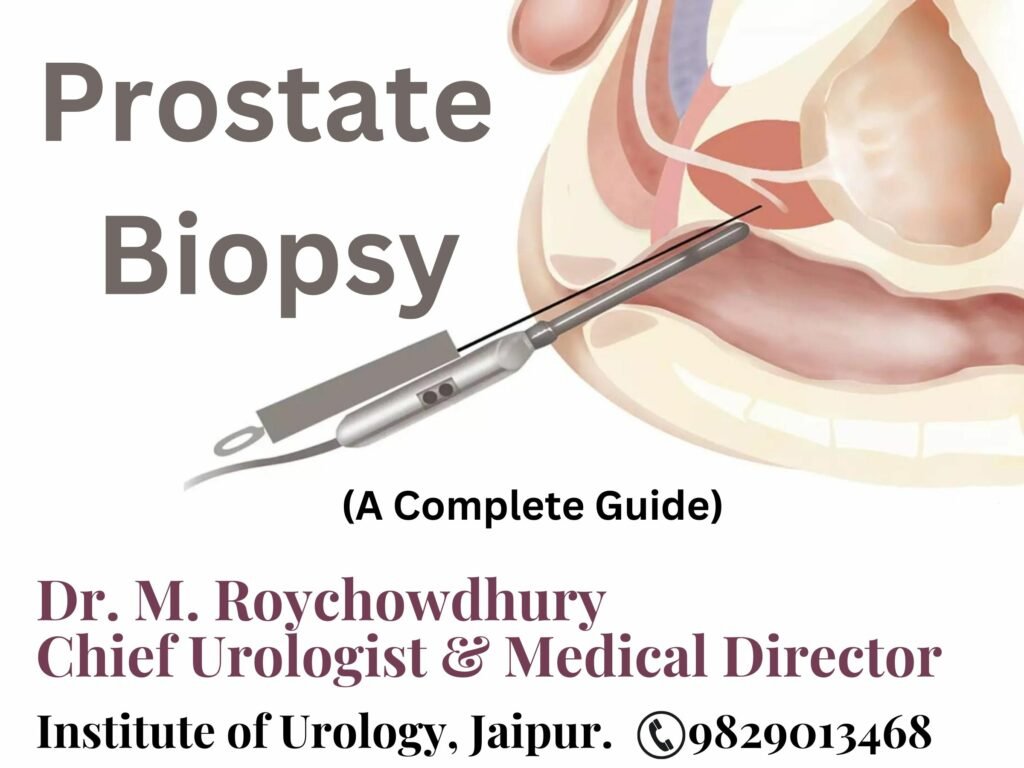 Prostate Biopsy Dr. Rajan Bansal Dr. M ROychowdhury Best Urologist in Jaipur Rajasthan Prostate Cancer