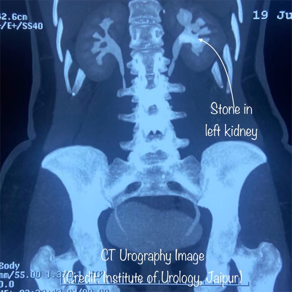 CT urography Dr Rajan Bansal