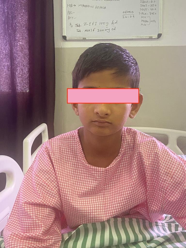 Best doctor for Hypospadias correction treatment surgery in India Rajasthan Jaipur Dr Rajan Bansal