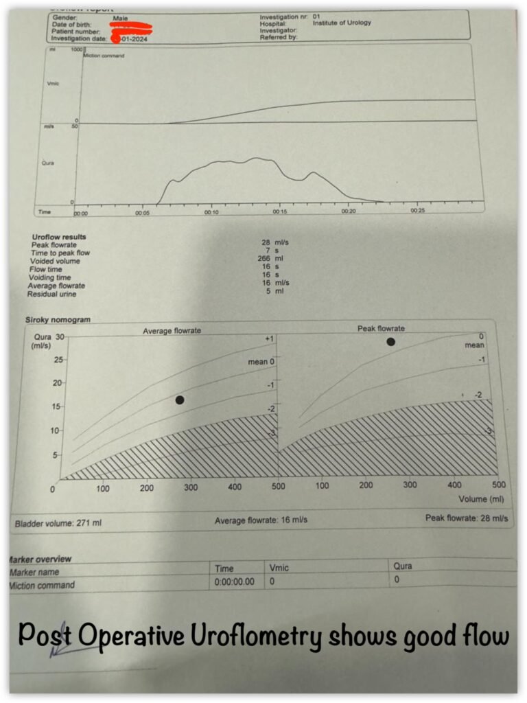 Uroflometry report