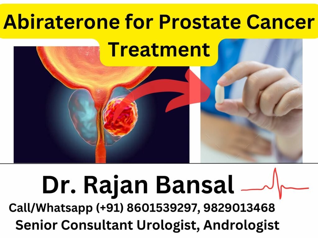 The Role of Abiraterone in Prostate Cancer Treatment