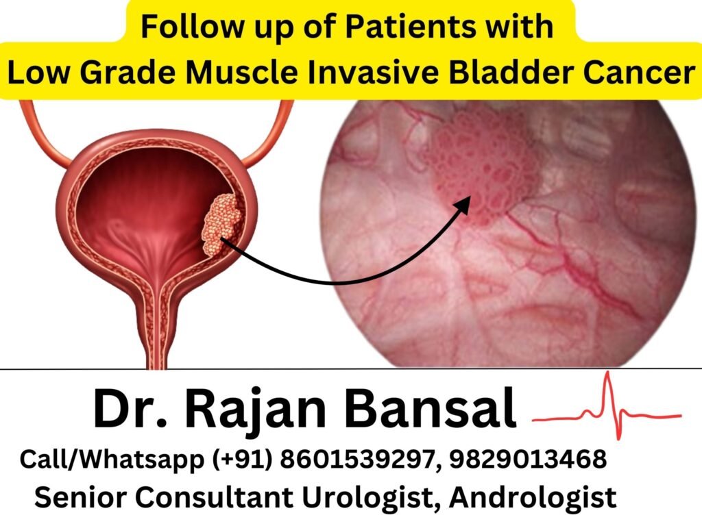 Low-Grade Non-Muscle Invasive Bladder Cancer (NMIBC) Treatment Best Doctor Jaipur Rajasthan Dr. M Roychowdhury Dr. Rajan Bansal