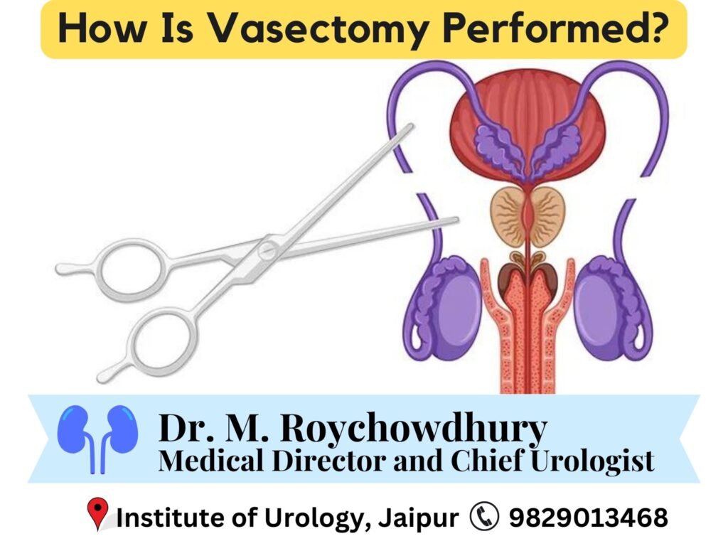 How Is Vasectomy Performed? Dr M Roychowdhury Dr Rajan Bansal Urologist