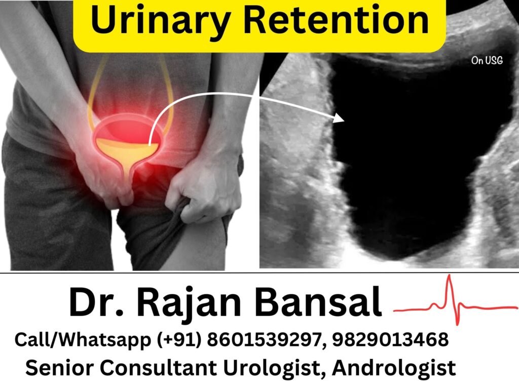 Urinary Retention Treatment by Dr. Rajan Bansal M Roychowdhury Jaipur C Scheme Best Urology Hospital