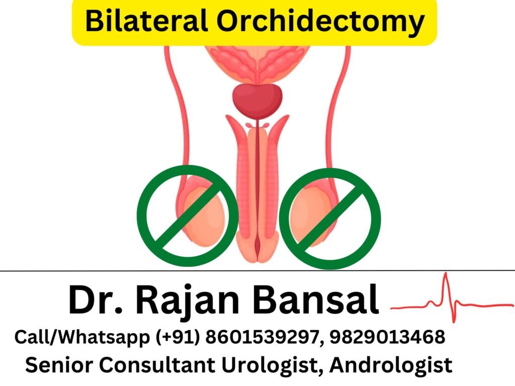 Bilateral Orchidectomy Dr Rajan Bansal Dr M Roychowdhury