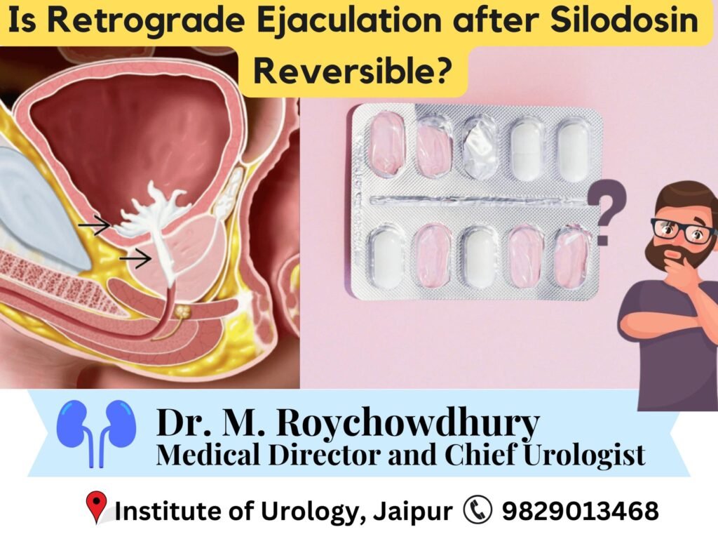 Is Retrograde Ejaculation After Silodosin Reversible? Dr M Roychowdhury