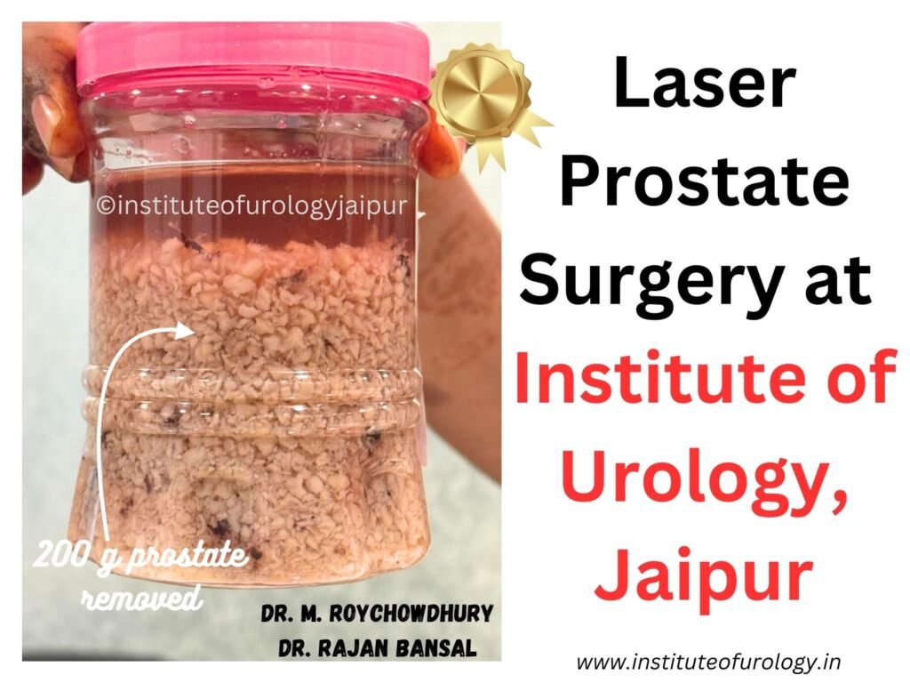 Laser Surgery for Very Large Prostate at Institute of Urology, Jaipur