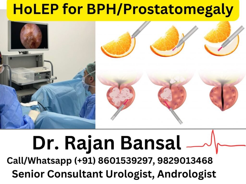 Use of Holmium Laser Enucleation (HoLEP) for Benign Prostatic Hyperplasia (BPH)- A Comprehensive Review