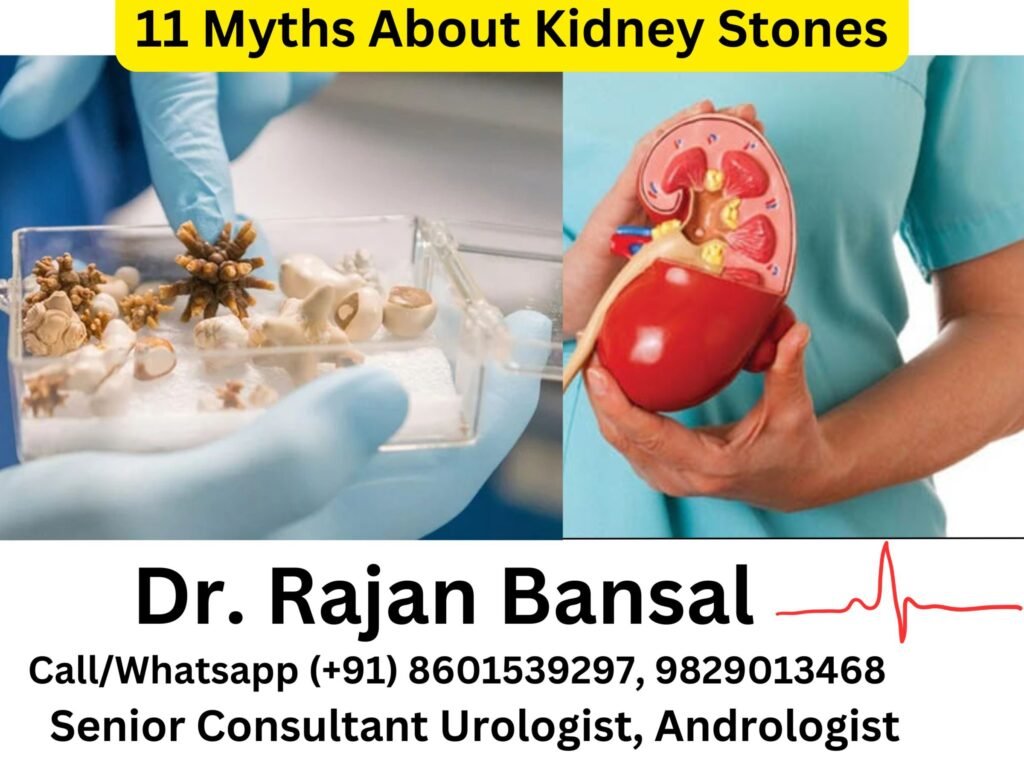 11 Myths About Kidney Stones That You Should Know About Dr Rajan Bansal Dr M Roychowdhury