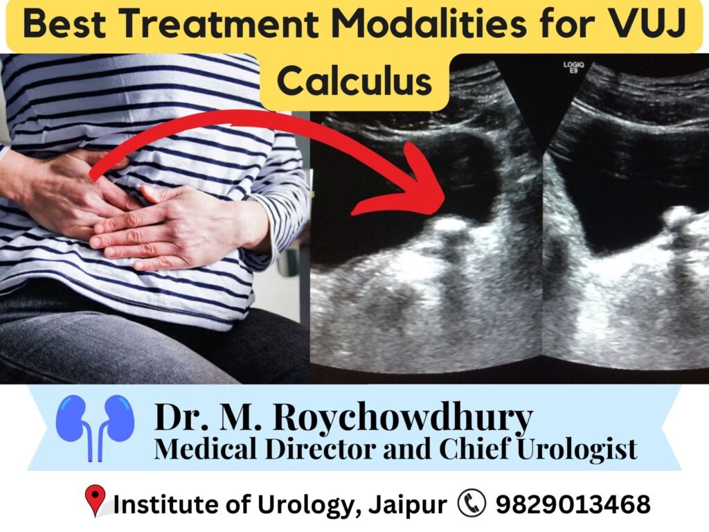 Best Treatment Modalities for VUJ Calculus Dr. M Roychowdhury Dr. Rajan Bansal