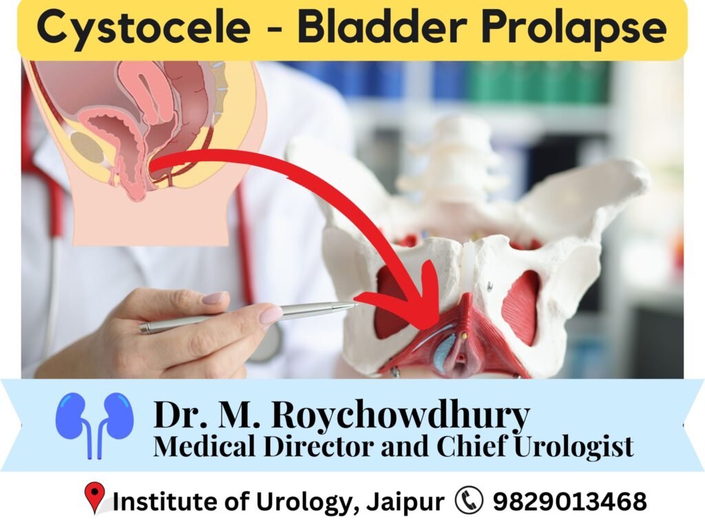 Cystocele- Understanding and Managing Bladder Prolapse Dr m roychowdhury Dr rajan bansal
