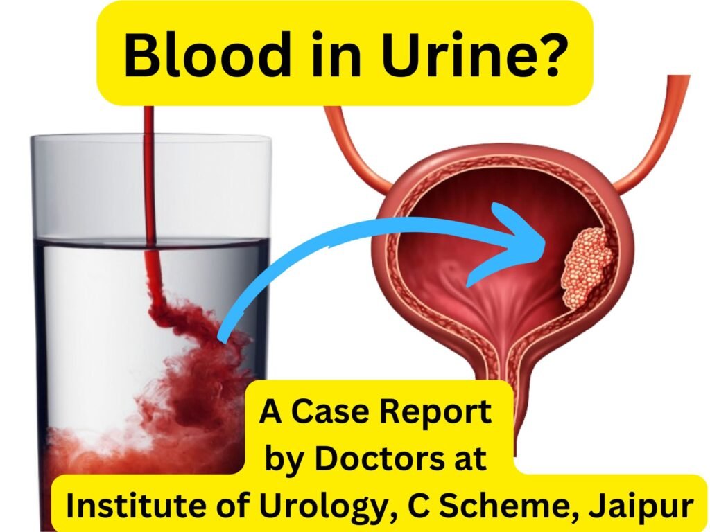 Hematuria in a 90-Year-Old Male Leading to the Diagnosis of Bladder Tumor