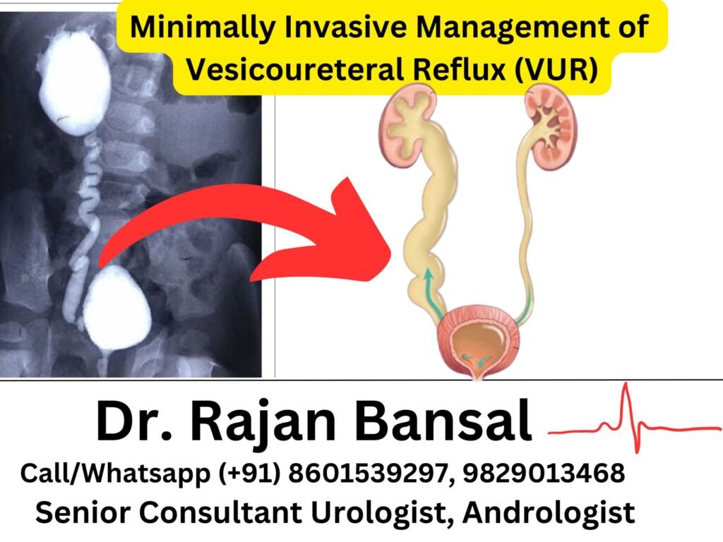 Minimally Invasive Management of Vesicoureteral Reflux (VUR)- Comparison of Endoscopic and Laparoscopic Approaches