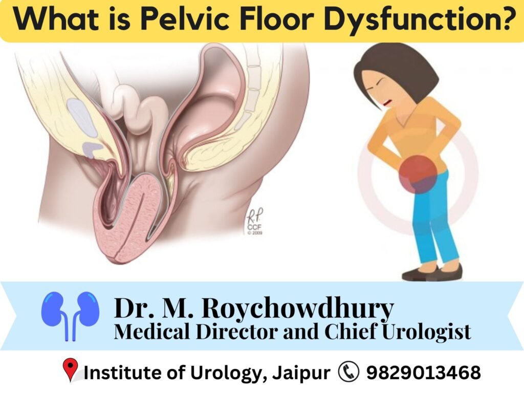 What is Pelvic Floor Dysfunction?
