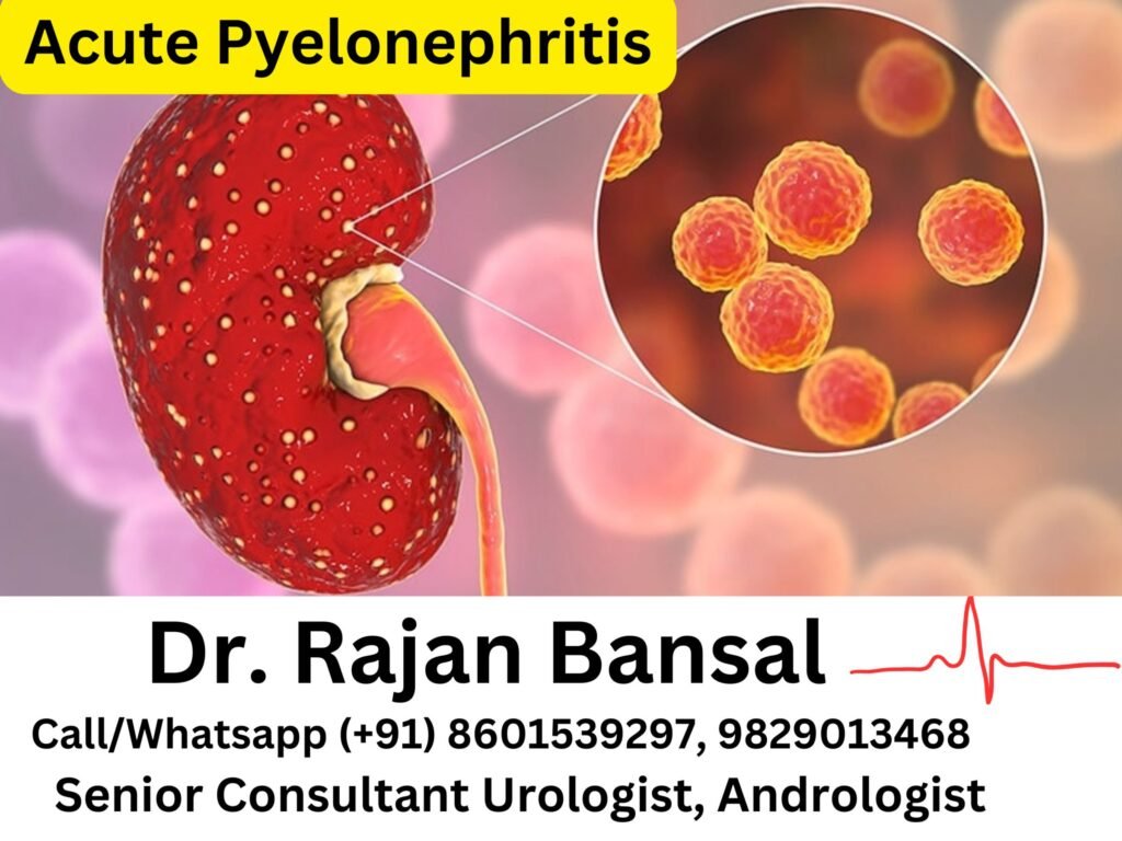 Acute Pyelonephritis- Causes, Symptoms, Diagnosis, and Treatment
