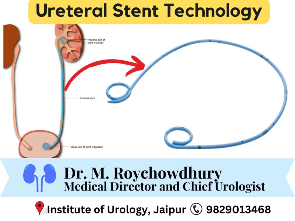 Ureteral Stent Technology Dr M Roychowdhury, Dr Rajan Bansal