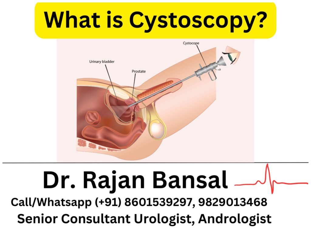What is Cystoscopy? How is it Performed?