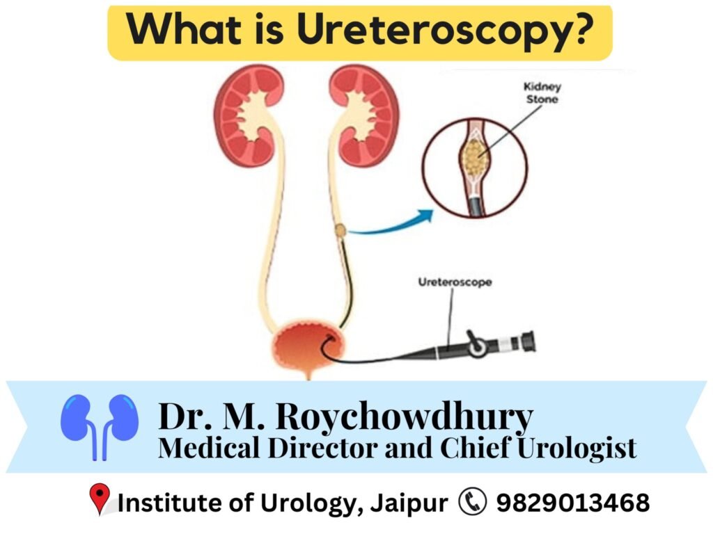 What is Ureteroscopy? How is it Performed?