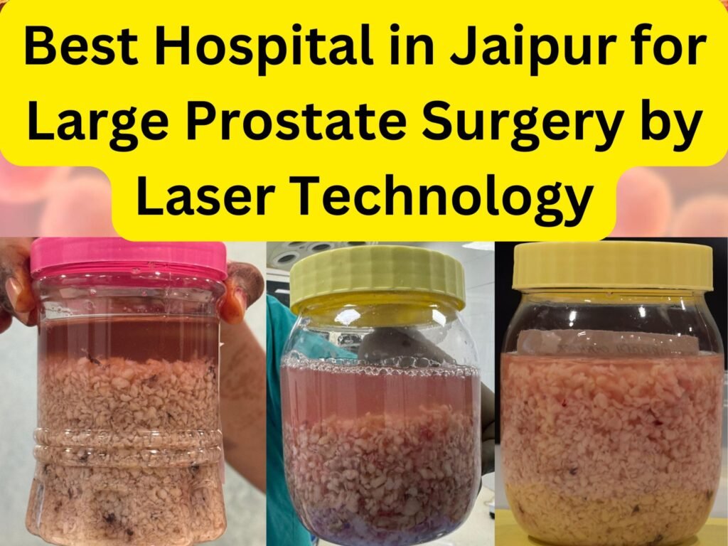 Best Hospital in Jaipur for Large Prostate Surgery by Laser Technology