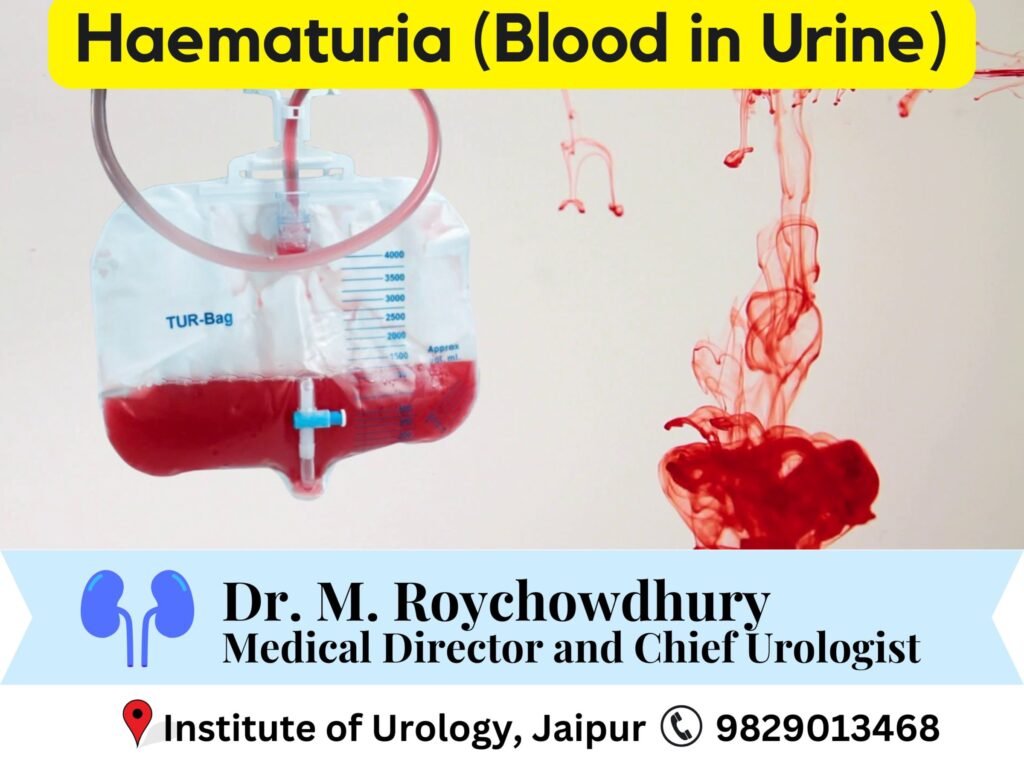 Haematuria- Causes, Diagnosis, and Management Dr M Roychowdhury Dr Rajan Bansal