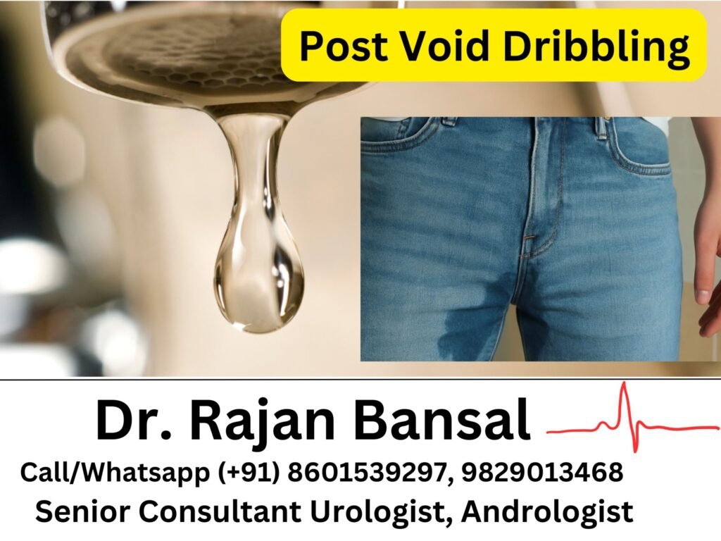 Post Void Dribbling - Causes and Treatment Dr M Roychowdhury Dr Rajan Bansal