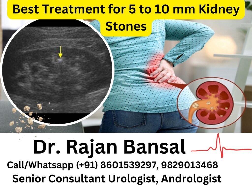 Best Treatment for 5 to 10 mm Kidney Stones Dr M Roychowdhury Dr Rajan Bansal
