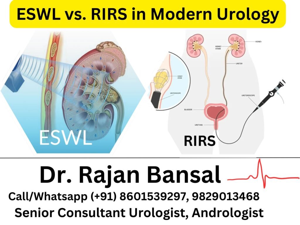 ESWL vs. RIRS in Modern Urology Practice Dr M Roychowdhury Dr Rajan Bansal
