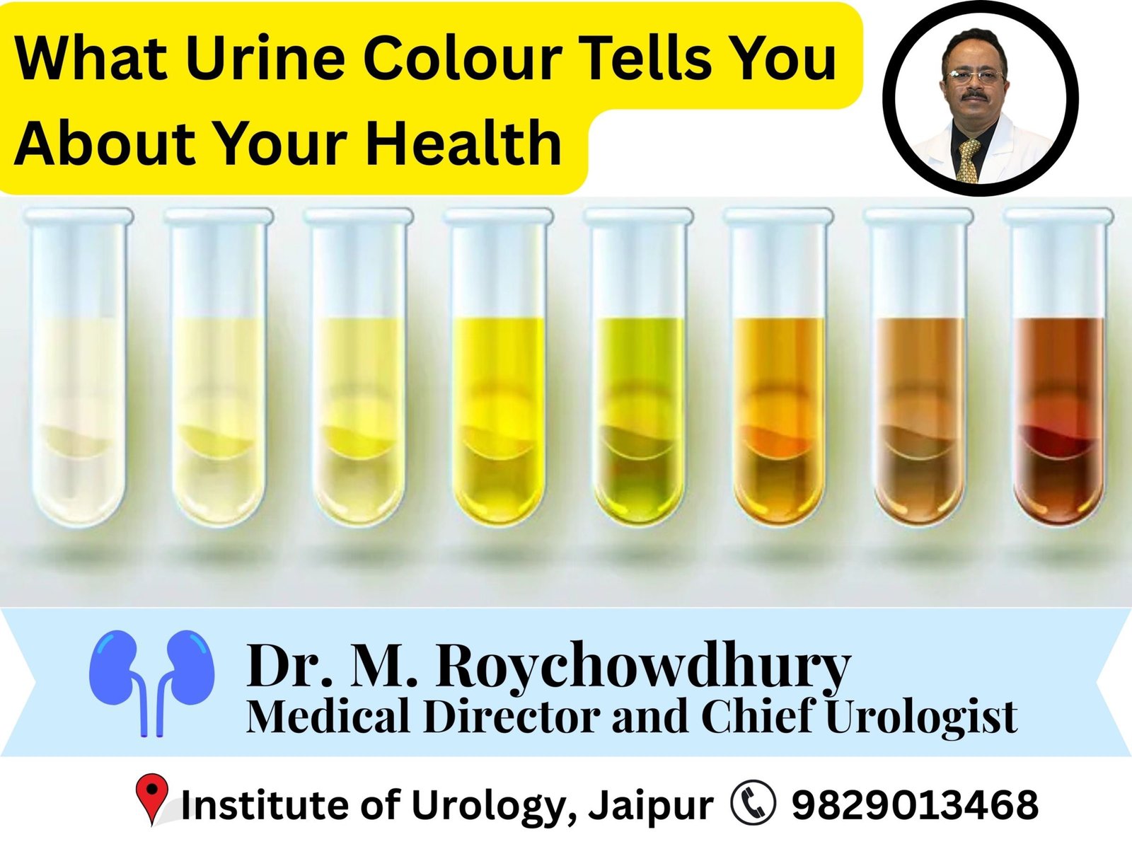 What Urine Colour Tells You About Your Health - Institute of Urology, Jaipur Explains Dr M Roychowdhury Dr Rajan Bansal What Urine Colour Tells You About Your Health - Institute of Urology, Jaipur Explains Dr M Roychowdhury Dr Rajan Bansal