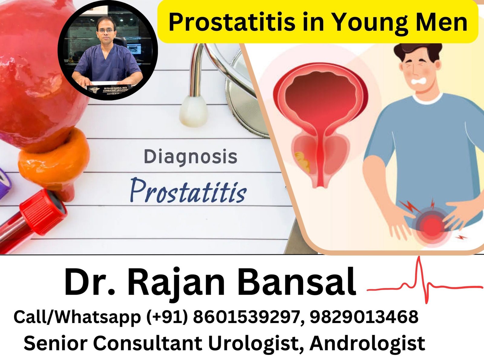 Prostatitis in Young Men Dr Rajan Bansal Dr M Roychowdhury Prostatitis in Young Men Dr Rajan Bansal Dr M Roychowdhury