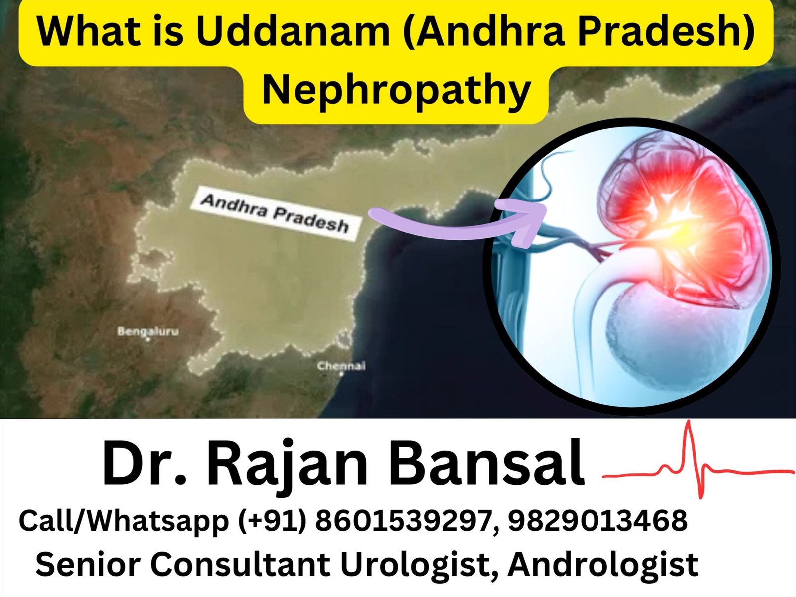 What is Uddanam (Andhra Pradesh) Nephropathy — and why does this region have so much chronic kidney disease? Dr Rajan Bansal