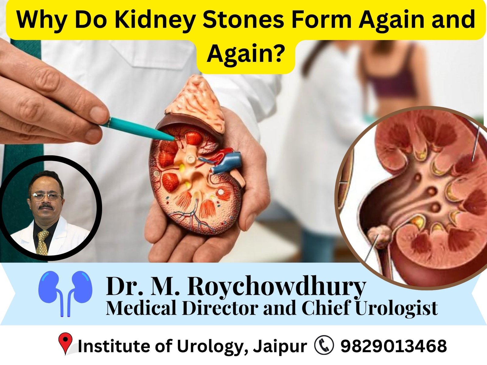 Why Do Kidney Stones Form Again and Again? Prevention Tips That Work Dr M Roychowdhury Dr Rajan Bansal