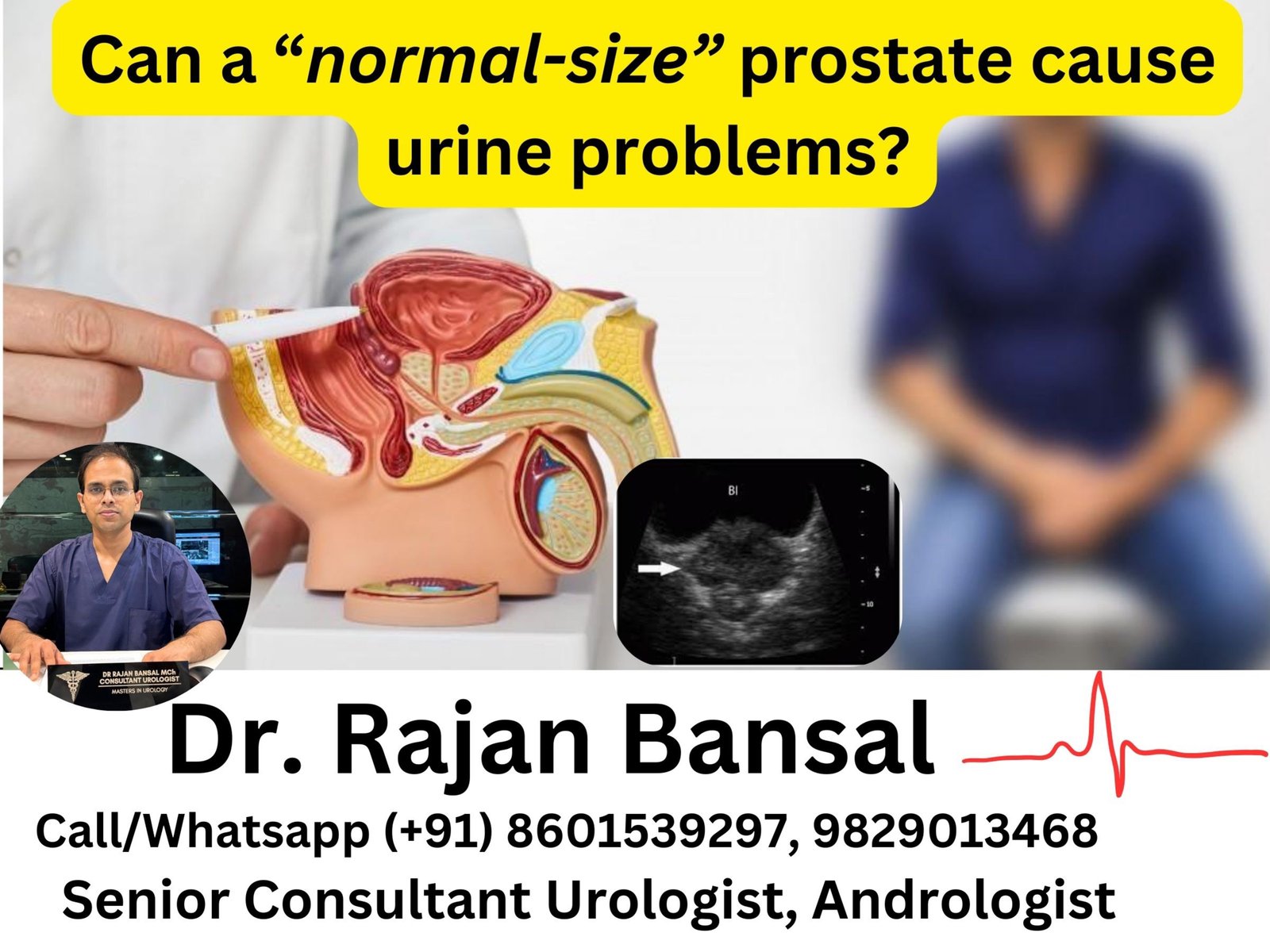 Can a normal-size prostate cause urine problems? Can a normal-size prostate cause urine problems?