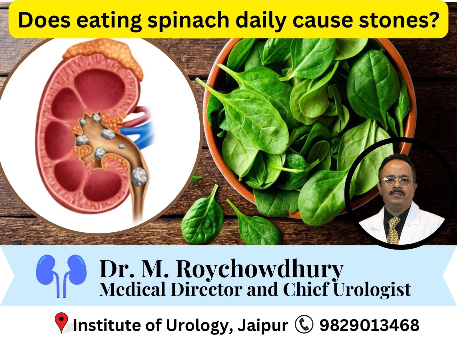 Does eating spinach daily cause stones? Tamarind, jaggery, dal — what helps vs harms if you had a kidney stone