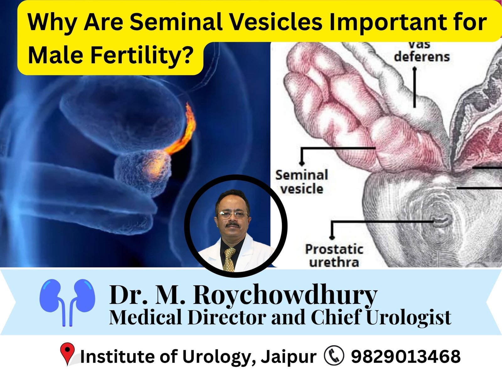 What Are Seminal Vesicles and Why Are They Important for Male Fertility? Dr M Roychowdhury What Are Seminal Vesicles and Why Are They Important for Male Fertility? Dr M Roychowdhury