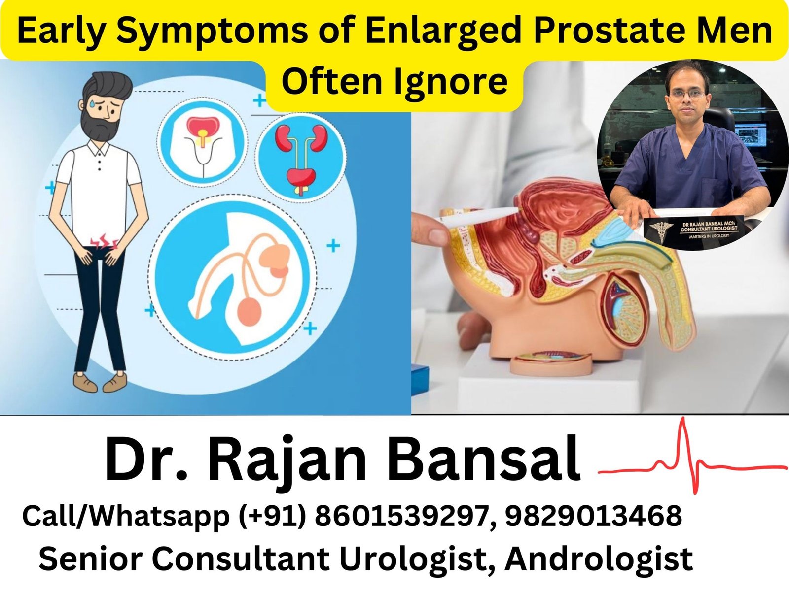 Early Symptoms of Enlarged Prostate Men Often Ignore Dr M roychowdhury Dr Rajan Bansal Early Symptoms of Enlarged Prostate Men Often Ignore Dr M roychowdhury Dr Rajan Bansal