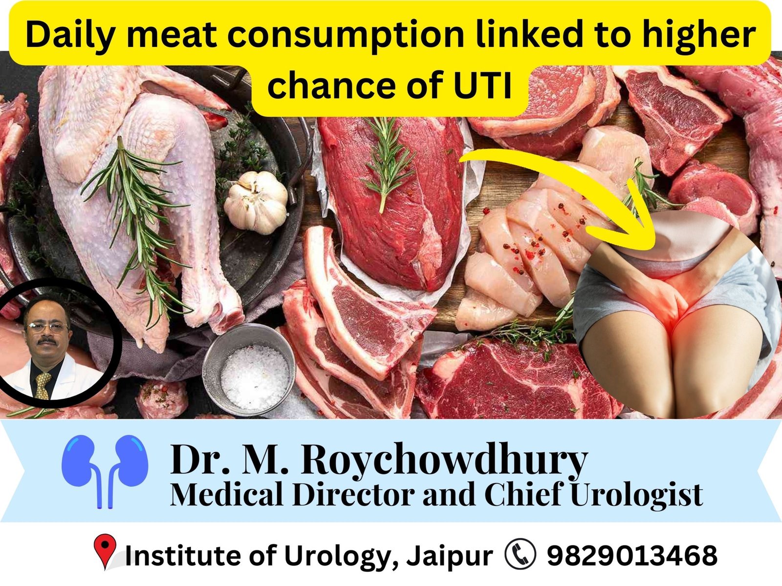 Daily meat consumption linked to higher chance of UTI Dr M Roychowdhury Dr Rajan Bansal Daily meat consumption linked to higher chance of UTI Dr M Roychowdhury Dr Rajan Bansal