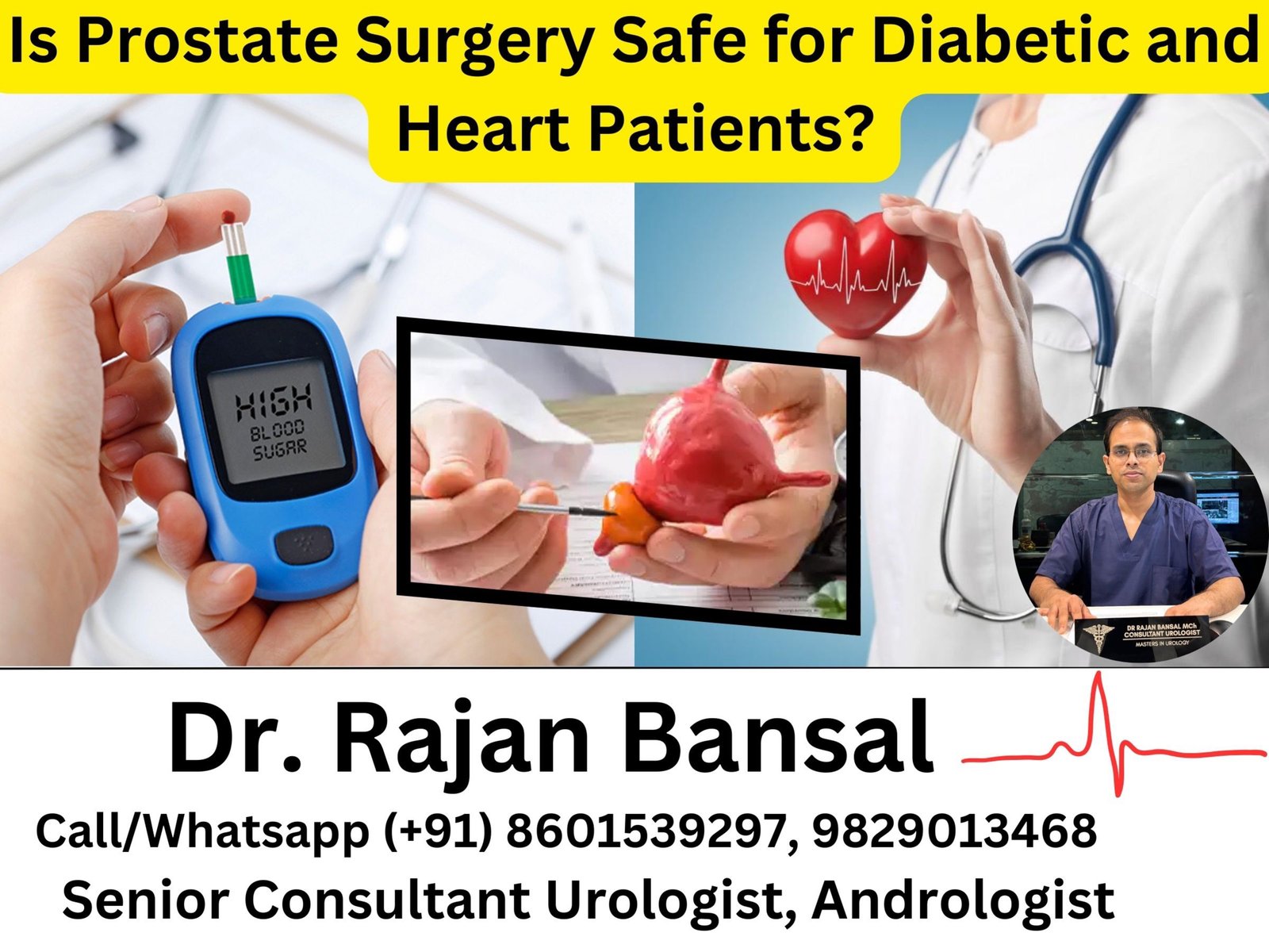 Is Prostate Surgery Safe for Diabetic and Heart Patients? Dr M Roychowdhury Dr Rajan bansal Is Prostate Surgery Safe for Diabetic and Heart Patients? Dr M Roychowdhury Dr Rajan bansal