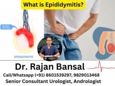 What is Epididymitis? A Complete Guide Dr M Roychowdhury Dr Rajan Bansal