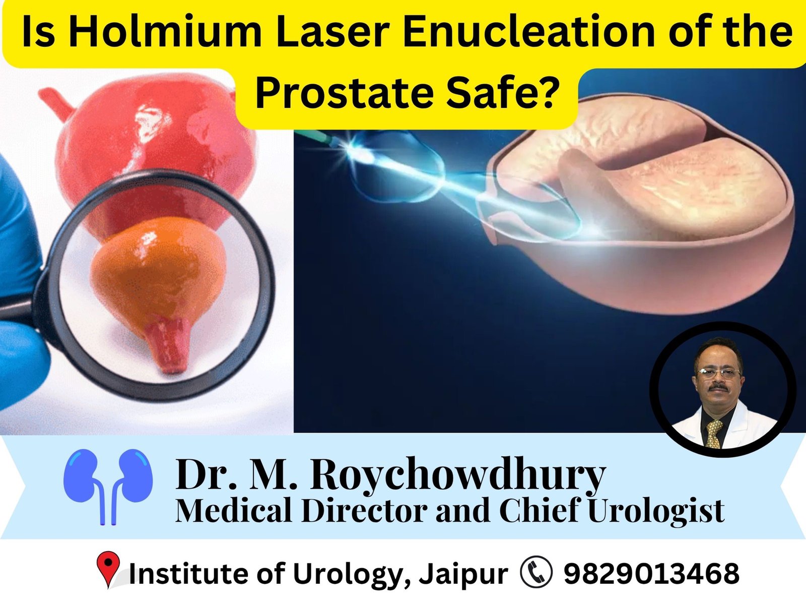 Laser Surgery for Prostate – Is Holmium Laser Enucleation of the Prostate Safe?